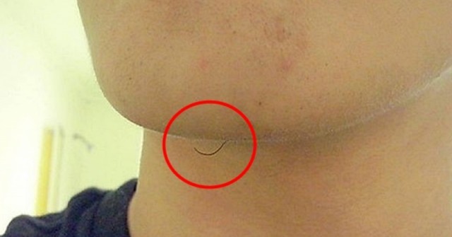Ако имате окосмяване по брадичката: Ето какво НАИСТИНА ОЗНАЧАВА